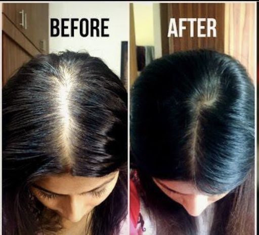 ✨ LuxeRoot™ Premium Instant Gray Hair Cover Stick | 💧 Waterproof | 💦 Sweatproof | 👨‍🦱👩‍🦰 For Men & Women